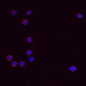 IL-13 antibody in Mouse Splenocytes by Immunocytochemistry (ICC).