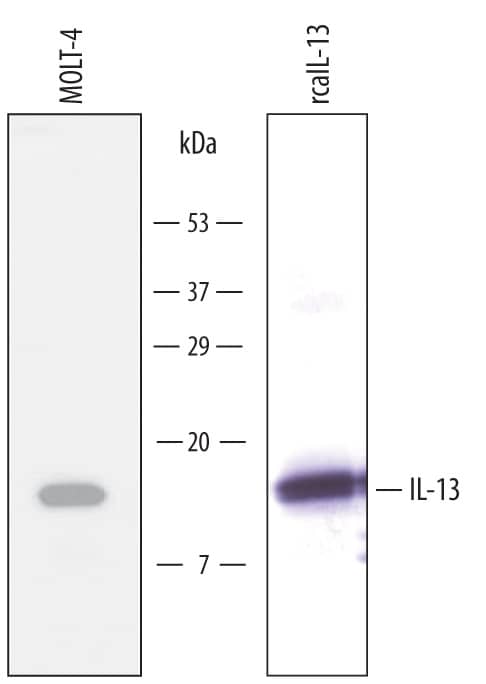 Detection of Human/Canine IL-13 antibody by Western Blot.