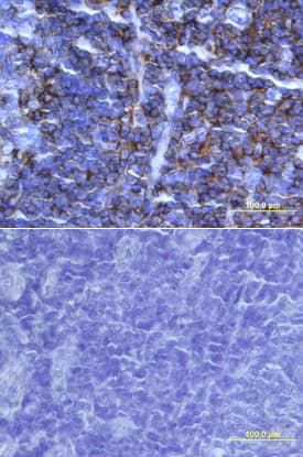 IL-16 antibody in Human Tonsil by Immunohistochemistry (IHC-P).