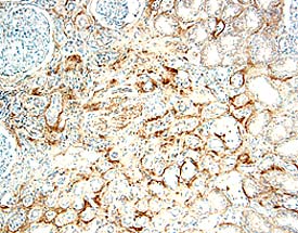 IL-17 RB antibody in Human Kidney by Immunohistochemistry (IHC-P).