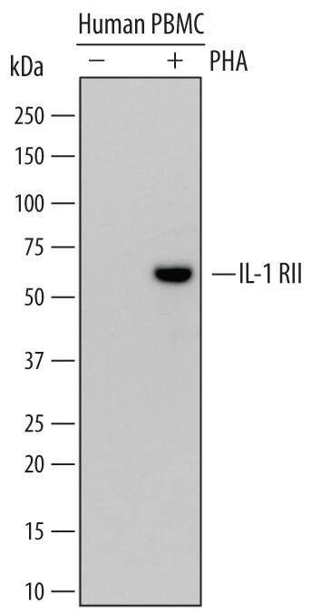 Detection of Human IL-1 RII antibody by Western Blot.