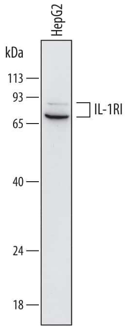 Detection of Human IL-1 RI antibody by Western Blot.