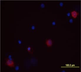 IL-1a/IL-1F1 antibody in Human PBMCs by Immunocytochemistry (ICC).