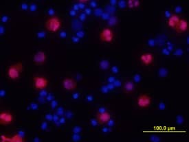 IL-1a/IL-1F1 antibody in Human PBMCs by Immunocytochemistry (ICC).