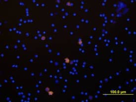 IL-1a/IL-1F1 antibody in Human PBMCs by Immunocytochemistry (ICC).