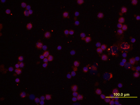 IL-1a/IL-1F1 antibody in Human PBMCs by Immunocytochemistry (ICC).