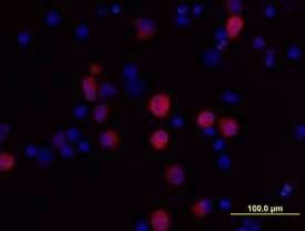 IL-1 beta/IL-1F2 antibody in Human PBMCs by Immunocytochemistry (ICC).