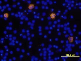 IL-1 beta/IL-1F2 antibody in Human PBMCs by Immunocytochemistry (ICC).