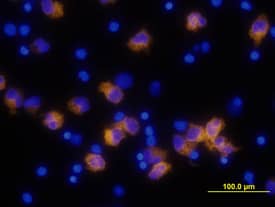 IL-1 beta/IL-1F2 antibody in Human PBMCs by Immunocytochemistry (ICC).