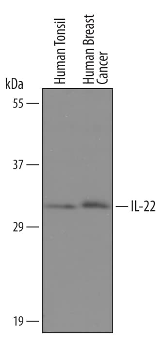 Detection of Human IL-22 antibody by Western Blot.