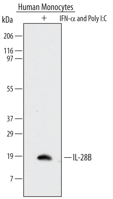 Detection of Human IL-28B/IFN-?3 antibody by Western Blot.