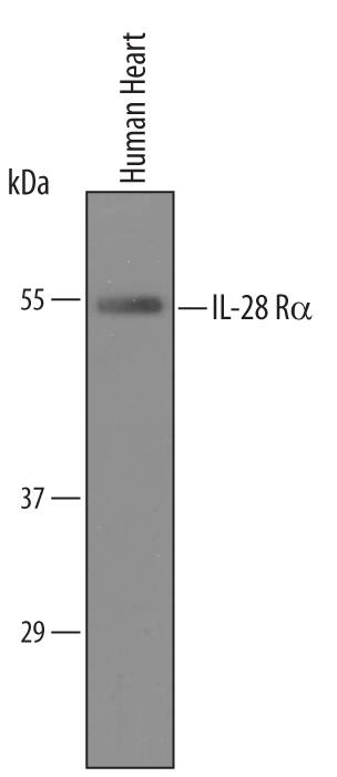 Detection of Human IL-28 Ra/IFN-? R1 antibody by Western Blot.