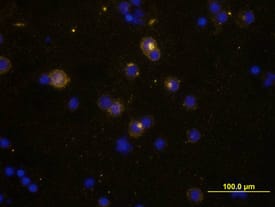 IL-2 antibody in Human PBMCs by Immunocytochemistry (ICC).