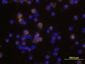 IL-2 antibody in Feline PBMCs by Immunocytochemistry (ICC).