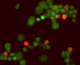 IL-2 antibody in Human PBMCs by Immunocytochemistry (ICC).