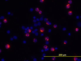 IL-2 antibody in Human PBMCs by Immunocytochemistry (ICC).