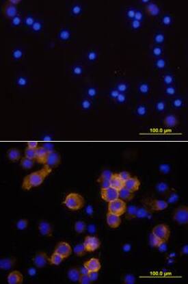 CD25/IL-2 Ra antibody in Human PBMCs by Immunocytochemistry (ICC).