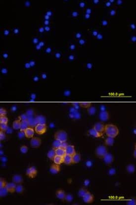 CD25/IL-2 Ra antibody in Human PBMCs by Immunocytochemistry (ICC).