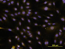 IL-33 antibody in HUVEC Human Cells by Immunocytochemistry (ICC).