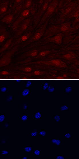 IL-33 antibody in bEnd by Immunocytochemistry (ICC).3 Mouse Cell Line by Immunocytochemistry (ICC).