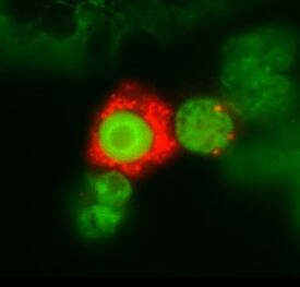 IL-3 Ra/CD123 antibody in Human Peripheral Blood Lymphocytes by Immunocytochemistry (ICC).