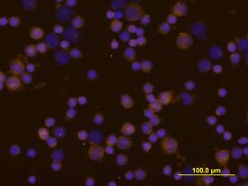 IL-4 antibody in Equine PBMCs by Immunocytochemistry (ICC).