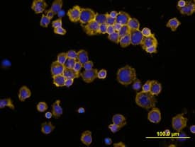 IL-4 antibody in Human PBMCs by Immunocytochemistry (ICC).