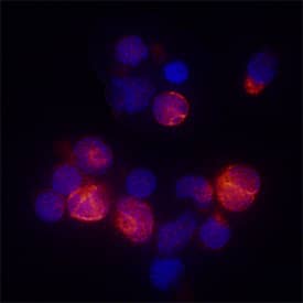 IL-4 Ra antibody in Human PBMCs by Immunocytochemistry (ICC).