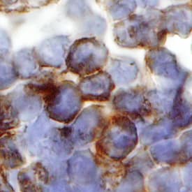 IL-4 Ra antibody in Human Lymph Node by Immunohistochemistry (IHC-P).