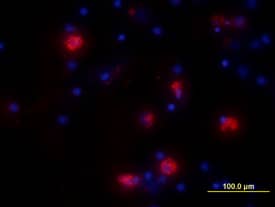 IL-6 antibody in Human PBMCs by Immunocytochemistry (ICC).