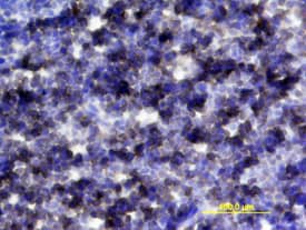 IL-6R alpha antibody in Mouse Thymus by Immunohistochemistry (IHC-Fr).