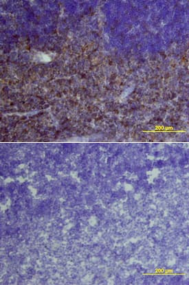 IL-6R alpha antibody in Mouse Thymus by Immunohistochemistry (IHC-Fr).