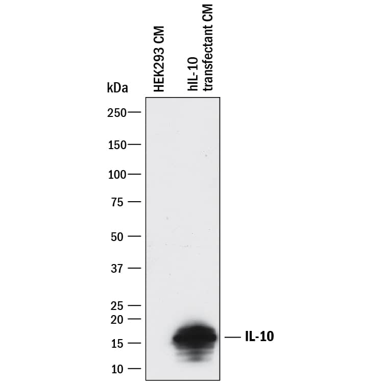 Detection of Human IL-10 antibody by Western Blot.