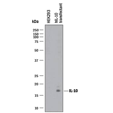 Detection of Human IL-10 antibody by Western Blot.