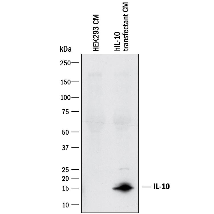 Detection of Human IL-10 antibody by Western Blot.