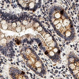 IL-10 antibody in Human Duodenum by Immunohistochemistry (IHC-P).