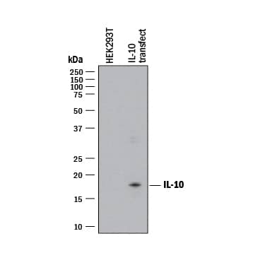 Detection of Human IL-10 antibody by Western Blot.