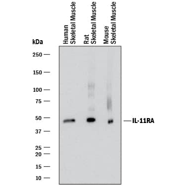 Detection of Human, Mouse, and Rat IL-11 Ra antibody by Western Blot.