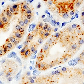 IL-15R alpha antibody in Human Kidney by Immunohistochemistry (IHC-P).