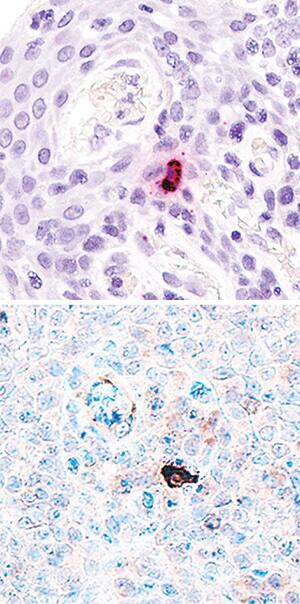 IL-17F antibody in Human Tonsil Using Dual RNAscope®ISH and IHC.