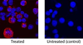 IL-17F antibody in Mouse Th17 Cells by Immunocytochemistry (ICC).