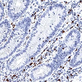 IL-17/IL-17A antibody in Human Crohn's Disease Intestine by Immunohistochemistry (IHC-P).