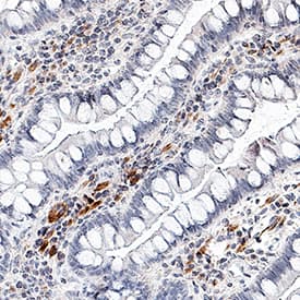 IL-17/IL-17A antibody in Human Crohn's Disease Intestine by Immunohistochemistry (IHC-P).