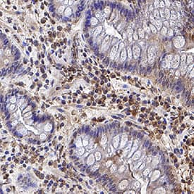 IL-17/IL-17A antibody in Human Crohn's Disease Intestine by Immunohistochemistry (IHC-P).