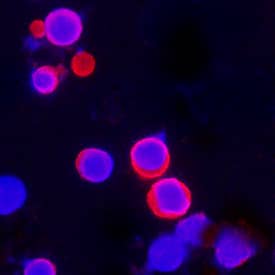 IL-18/IL-1F4 antibody in Splenocytes by Immunocytochemistry (ICC).