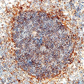IL-1 RII antibody in Mouse Spleen by Immunohistochemistry (IHC-Fr).