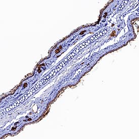 IL-1 RI antibody in Mouse Skin by Immunohistochemistry (IHC-Fr).