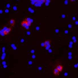 IL-1a/IL-1F1 antibody in Human PBMCs by Immunocytochemistry (ICC).