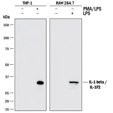Detection of Human and Mouse IL-1 beta/IL-1F2 antibody by Western Blot.