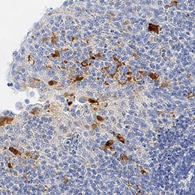 IL-1 beta/IL-1F2 antibody in Human Tonsil by Immunohistochemistry (IHC-P).